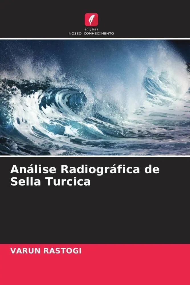 Análise Radiográfica de Sella Turcica / Varun Rastogi / Taschenbuch / Portugiesisch / 2022 / Edições Nosso Conhecimento / EAN 9786204547527 - Rastogi, Varun