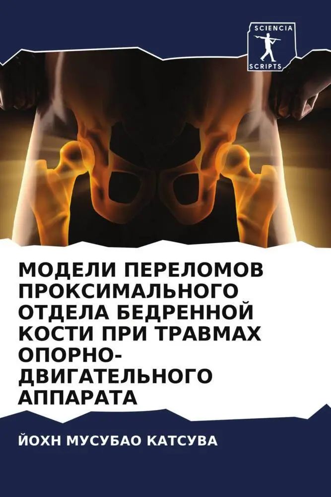 MODELI PERELOMOV PROKSIMAL'NOGO OTDELA BEDRENNOJ KOSTI PRI TRAVMAH OPORNO-DVIGATEL'NOGO APPARATA / John Musubao Katsuva / Taschenbuch / Russisch / 2022 / Sciencia Scripts / EAN 9786204669038 - Katsuva, John Musubao
