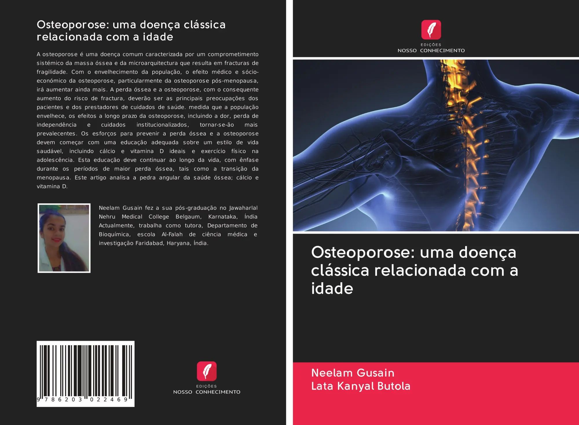 Osteoporose: uma doença clássica relacionada com a idade / Neelam Gusain (u. a.) / Taschenbuch / Portugiesisch / 2020 / Edições Nosso Conhecimento / EAN 9786203022469 - Gusain, Neelam