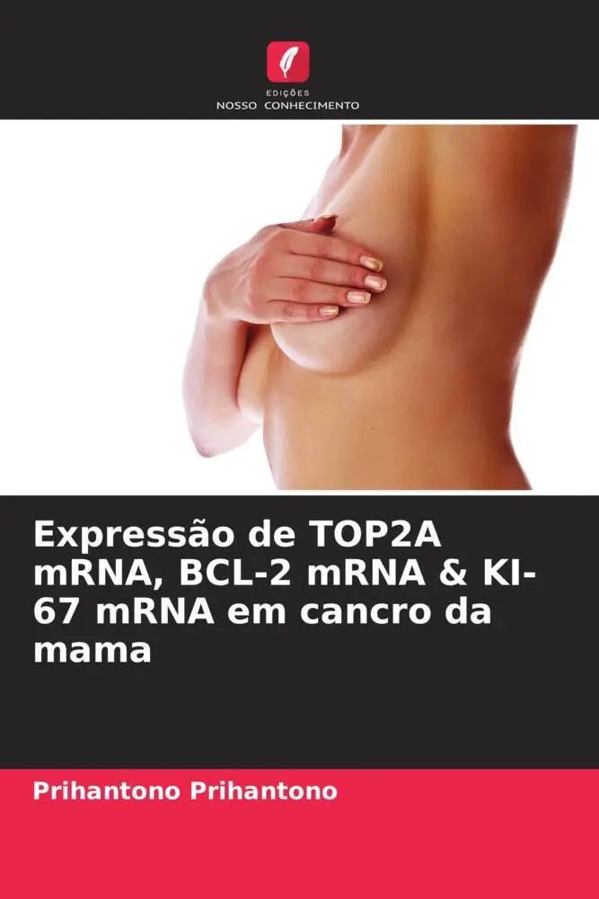 Expressão de TOP2A mRNA, BCL-2 mRNA & KI-67 mRNA em cancro da mama / Prihantono Prihantono / Taschenbuch / Portugiesisch / 2022 / Edições Nosso Conhecimento / EAN 9786205161180 - Prihantono, Prihantono