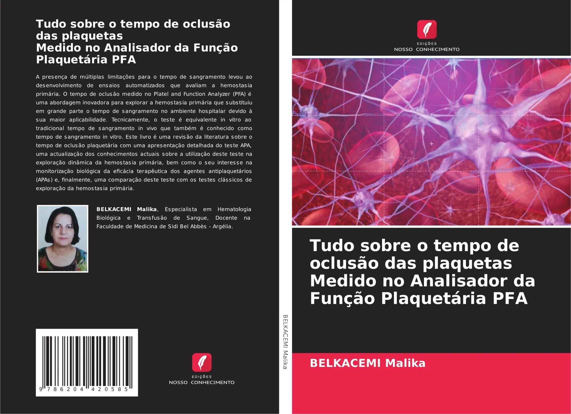 Tudo sobre o tempo de oclusão das plaquetas Medido no Analisador da Função Plaquetária PFA / Belkacemi Malika / Taschenbuch / Portugiesisch / 2022 / Edições Nosso Conhecimento / EAN 9786204420585 - Malika, Belkacemi